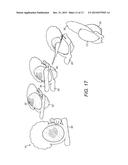 IMPROVED PACKAGING AND METHOD OF OPENING diagram and image