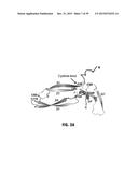 Norrin Mutant Polypeptides, Methods of Making and Uses Thereof diagram and image