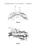 Norrin Mutant Polypeptides, Methods of Making and Uses Thereof diagram and image