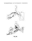 Norrin Mutant Polypeptides, Methods of Making and Uses Thereof diagram and image