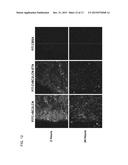 UNDIFFERENTIATED CELL ELIMINATION METHOD diagram and image