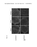 UNDIFFERENTIATED CELL ELIMINATION METHOD diagram and image