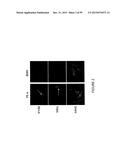 ADIPOSE-DERIVED STEM CELLS AND LATTICES diagram and image