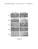 ADIPOSE-DERIVED STEM CELLS AND LATTICES diagram and image