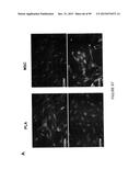 ADIPOSE-DERIVED STEM CELLS AND LATTICES diagram and image