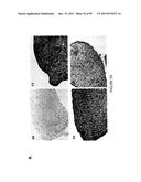 ADIPOSE-DERIVED STEM CELLS AND LATTICES diagram and image