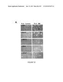 ADIPOSE-DERIVED STEM CELLS AND LATTICES diagram and image