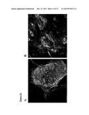 PANCREATIC INSULIN-PRODUCING BETA-CELL LINES DERIVED FROM HUMAN     PLURIPOTENT STEM CELLS diagram and image