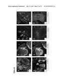 PANCREATIC INSULIN-PRODUCING BETA-CELL LINES DERIVED FROM HUMAN     PLURIPOTENT STEM CELLS diagram and image