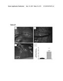 PANCREATIC INSULIN-PRODUCING BETA-CELL LINES DERIVED FROM HUMAN     PLURIPOTENT STEM CELLS diagram and image