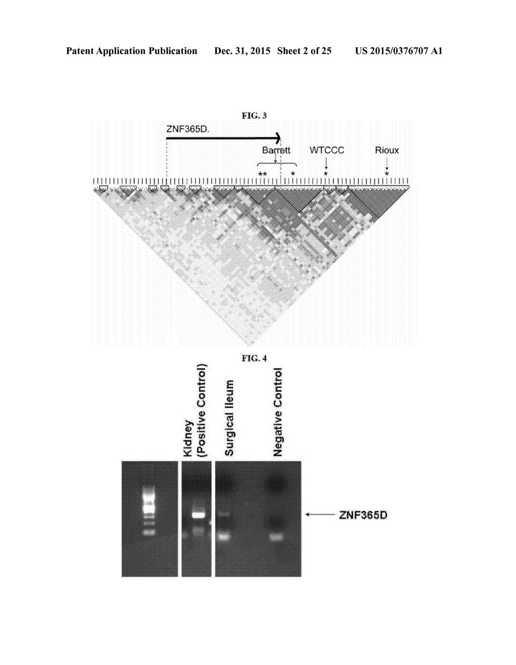 METHODS OF DIAGNOSING AND TREATING INFLAMMATORY BOWEL DISEASE - diagram, schematic, and image 03