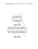 Axial, Lateral and Torsional Force Dampener diagram and image