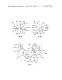 ROTATABLE CONNECTION WITH LIMITED ROTATIONAL ANGLE diagram and image