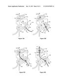 Dual Input Bump Alignment Assembly for an Imaging Device diagram and image