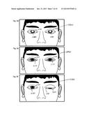 ADAPTABLE EYE ARTIFACT IDENTIFICATION AND CORRECTION SYSTEM diagram and image