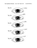 ADAPTABLE EYE ARTIFACT IDENTIFICATION AND CORRECTION SYSTEM diagram and image