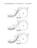 PROTECTING A SENSITIVE DEVICE FROM CORROSION diagram and image