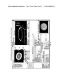 Vacuum Chuck with Polymeric Embossments diagram and image