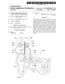 HEARING PROSTHESIS HAVING AN IMPLANTABLE ACTUATOR SYSTEM diagram and image