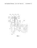 HEARING PROSTHESIS HAVING AN IMPLANTABLE ACTUATOR SYSTEM diagram and image