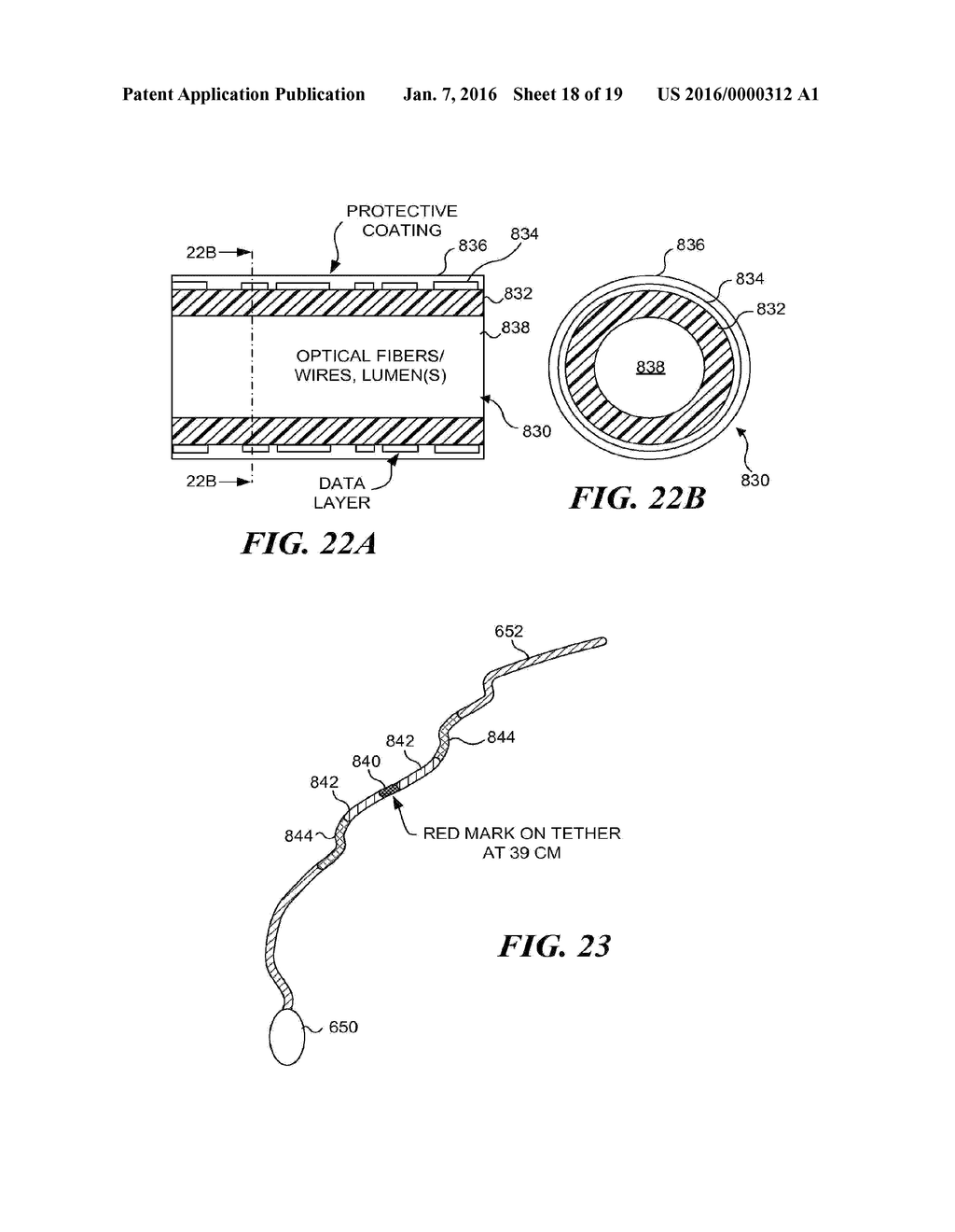 MONITORING DISPOSITION OF TETHERED CAPSULE ENDOSCOPE IN ESOPHAGUS - diagram, schematic, and image 19