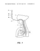 METHOD AND APPARATUS FOR PERFORMING TRANSESOPHAGEAL CARDIOVASCULAR     PROCEDURES diagram and image