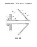 METHOD AND APPARATUS FOR PERFORMING TRANSESOPHAGEAL CARDIOVASCULAR     PROCEDURES diagram and image