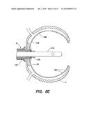 METHOD AND APPARATUS FOR PERFORMING TRANSESOPHAGEAL CARDIOVASCULAR     PROCEDURES diagram and image