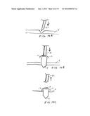 METHODS AND DEVICES FOR IMPLANTATION OF INTRAOCULAR PRESSURE SENSORS diagram and image