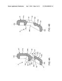 BLOOD PRESSURE MEASUREMENT CUFF AND ATTACHMENT METHOD FOR THE SAME diagram and image