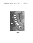 Assessing Optical Density Gradients and Variations diagram and image