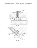 VESSEL CLOSURE DEVICES, SYSTEMS, AND METHODS diagram and image