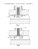 VESSEL CLOSURE DEVICES, SYSTEMS, AND METHODS diagram and image