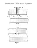 VESSEL CLOSURE DEVICES, SYSTEMS, AND METHODS diagram and image