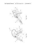SUTURING AND KNOTTING INTEGRATED DEVICE FOR LAPARAOSCOPIC SURGERY AND     ASSOCIATED KNOTTING ASSEMBLY diagram and image