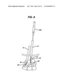 Methods and Devices for Minimally Invasive Spinal Fixation Element     Placement diagram and image