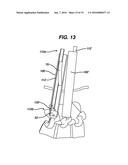 Methods and Devices for Minimally Invasive Spinal Fixation Element     Placement diagram and image