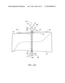 Fracture Fixation Device diagram and image