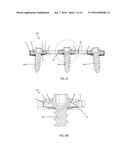 BONE ANCHOR LOCKING DEVICE diagram and image