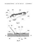 BONE PLATE WITH ATTACHABLE WEDGE diagram and image