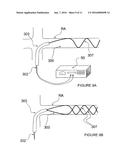 BALLOON CATHETER APPARATUSES FOR RENAL DENERVATION diagram and image