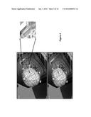 SYSTEM AND METHOD FOR DYNAMIC VALIDATION, CORRECTION OF REGISTRATION FOR     SURGICAL NAVIGATION diagram and image