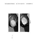 SYSTEM AND METHOD FOR DYNAMIC VALIDATION, CORRECTION OF REGISTRATION FOR     SURGICAL NAVIGATION diagram and image