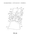 Replacement Head for An Oral Care Implement, And Oral Care Implement And     Method Of Utilizing The Same diagram and image