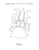 Replacement Head for An Oral Care Implement, And Oral Care Implement And     Method Of Utilizing The Same diagram and image