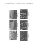 THIN FILM VASCULAR STENT FOR ARTERIAL DISEASE diagram and image