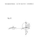 DELIVERY SYSTEMS FOR CARDIAC VALVE SUPPORT DEVICES diagram and image