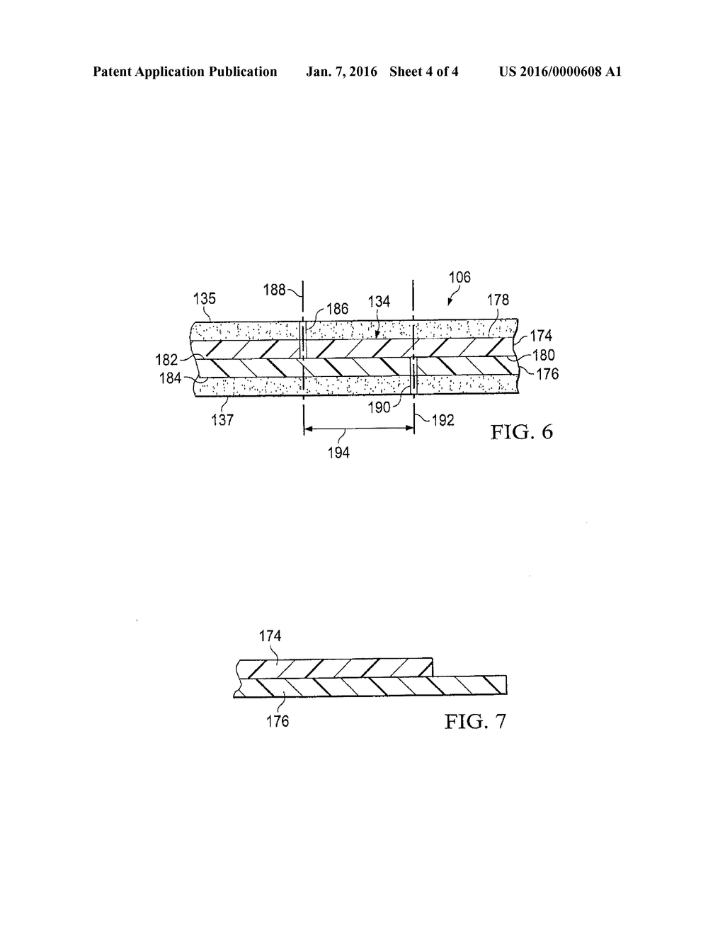 ADJUSTABLE REDUCED-PRESSURE WOUND COVERINGS - diagram, schematic, and image 05