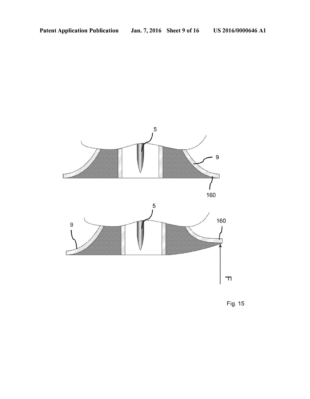 Application module for a handheld device for the repeated application of     an application element to a human skin or to an animal skin, and handheld     device - diagram, schematic, and image 10