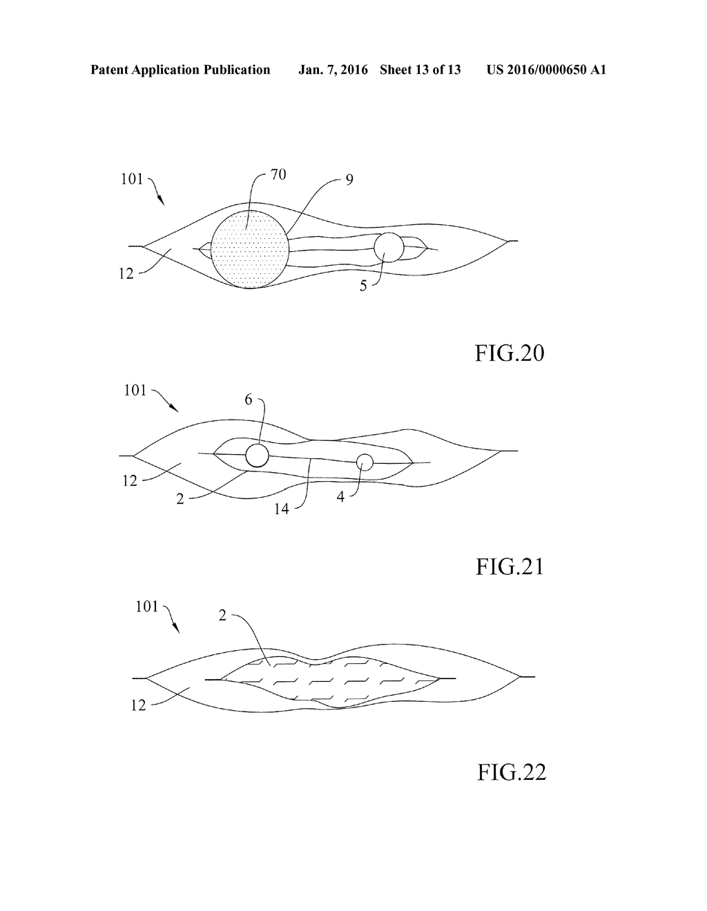 FLEXIBLE PACKAGE WITH A SEALED STERILE CHAMBER FOR THE RECONSITUTION AND     ADMINISTRATION OF FLUID MEDICINAL OR NUTRITIONAL SUBSTANCES INSTILLABLE     INTO THE BODY OF A PATIENT - diagram, schematic, and image 14